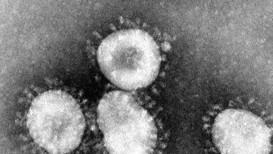 Coronavirus