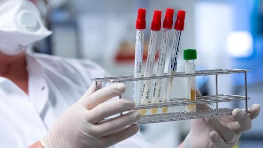 Coronavirus-Test