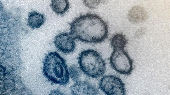Coronavirus