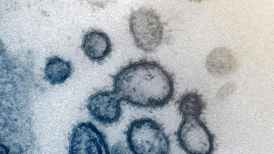 Coronavirus
