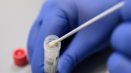 Coronavirus-Test