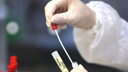 Coronavirus