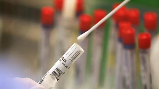 Coronavirus