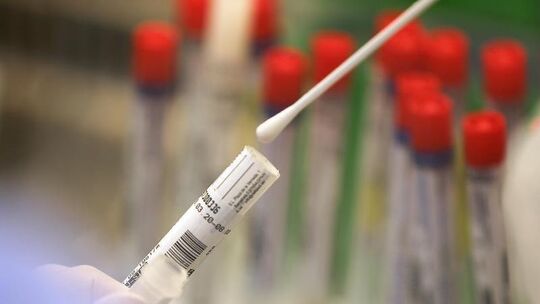 Coronavirus