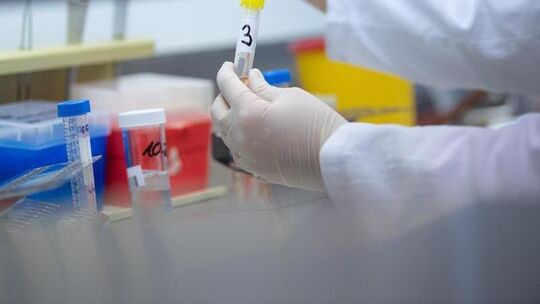 Eine Ärztin zeigt einen Test für das Coronavirus