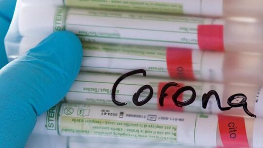 Symbolbild "Coronavirus - Test"