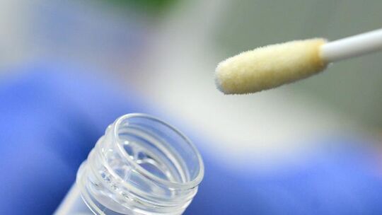 Ein Abstrich für das Testverfahren auf das Coronavirus