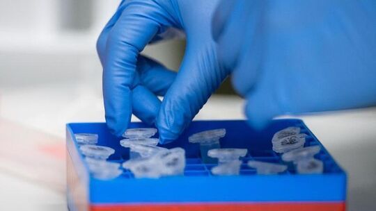 Untersuchungen zum Coronavirus