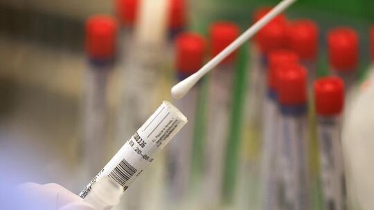Ein Abstrich wird in einem Labor auf das Coronavirus untersucht