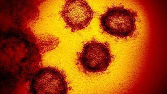 Coronavirus SARS-CoV-2