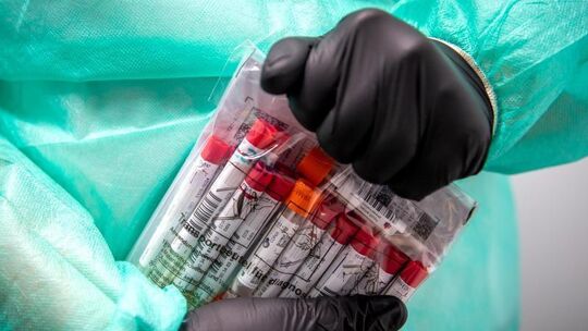 Proben für einen PCR-Test werden von einem Laboranten verpackt