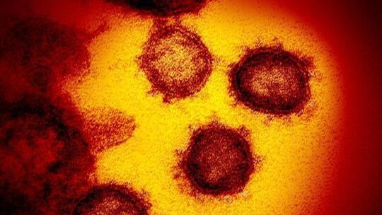 Coronavirus SARS-CoV-2