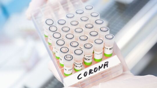 Corona-Test