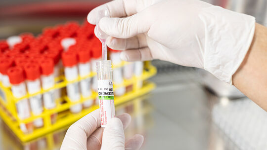 PCR-Test