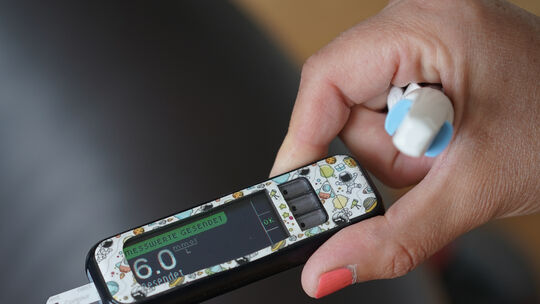 Diabetes mellitus Typ 1 bei Kindern