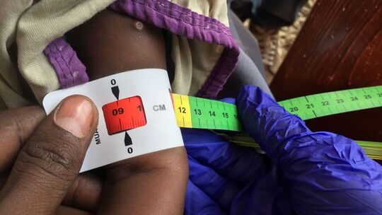 Tausende Kinder in Nord-Darfur von Hungertod bedroht