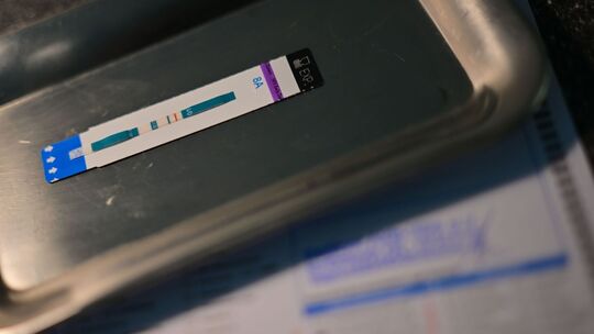 HIV-Test