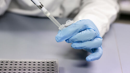 Die Proben müssen nun untersucht werden (Symbolfoto).