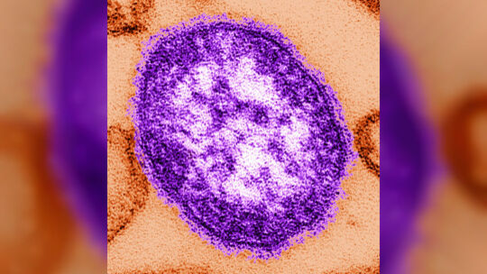 Masern - Virus Masern - Virus