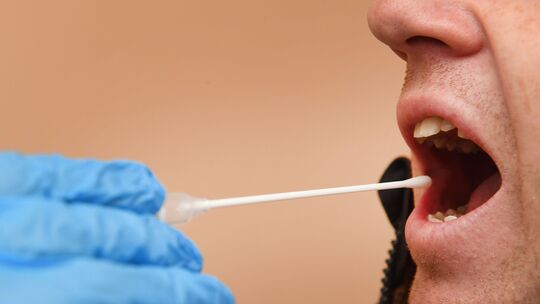 Fast 32 Jahre nach dem Mord an der US-Touristin Amy Lopez führte eine Speichelprobe zu ihrem mutmaßlichen Mörder. Die Koblenzer