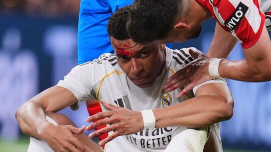 Real Madrid - FC Girona