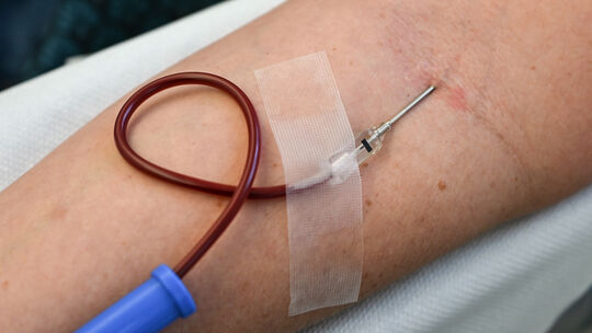 Blutspenden sind wichtig und nötig - aber so mancher hat Angst vor der Nadel.