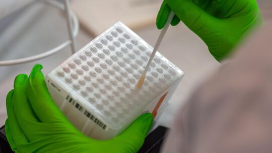 Im DKMS-Labor werden Wattestäbchen mit Zellen der Wangenschleimhaut für die Typisierung vorbereitet. Solche Proben sollen auch b