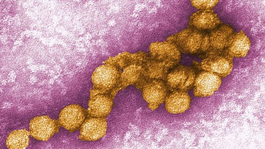 West-Nil-Virus West-Nil-Virus