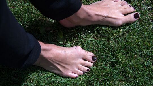 Füße einer Frau mit Zehenfehlstellung Hallux valgus Füße einer Frau mit Zehenfehlstellung Hallux valgus