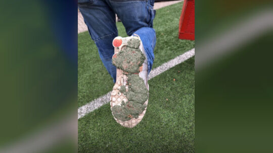 Unschöne Entwicklung: Das in der Hitze geschmolzene Granulat haftet an den Fußballschuhen.